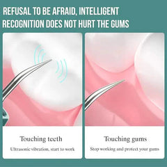 White Visual Ultrasonic Teeth Cleaner from DailySale, a compact device for professional-level dental hygiene.