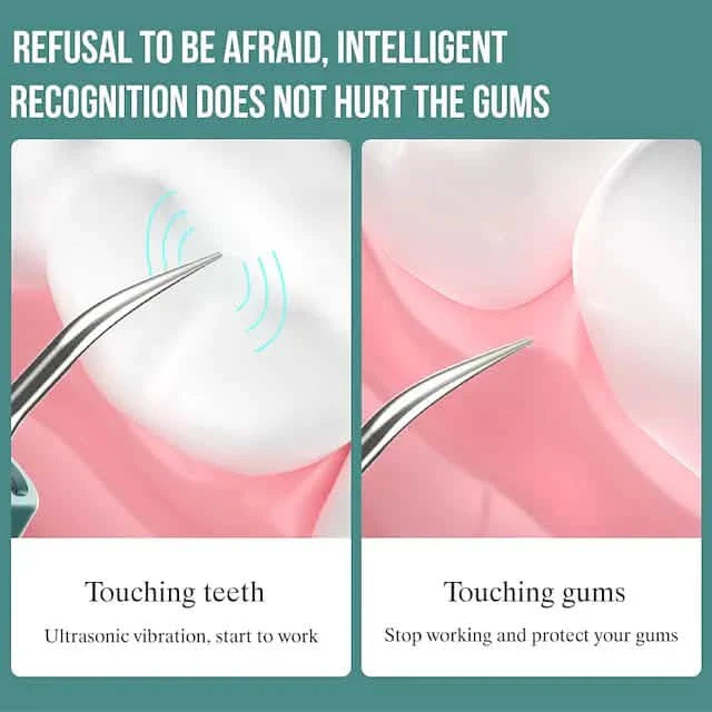 White Visual Ultrasonic Teeth Cleaner from DailySale, a compact device for professional-level dental hygiene.