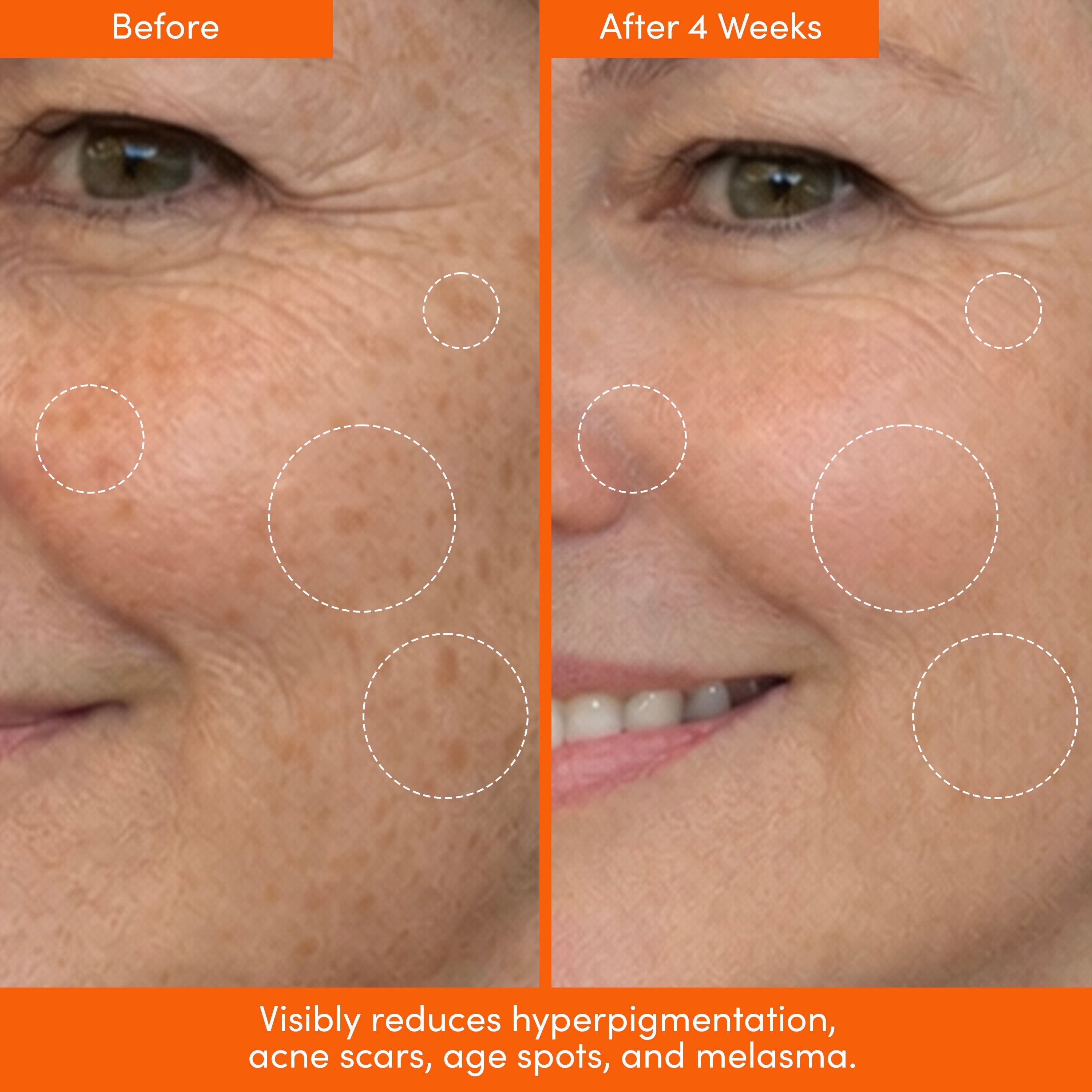 Lion Pose The Placenta Facial dark spot serum and triple lipid peptide cream set for skin repair and brightening.