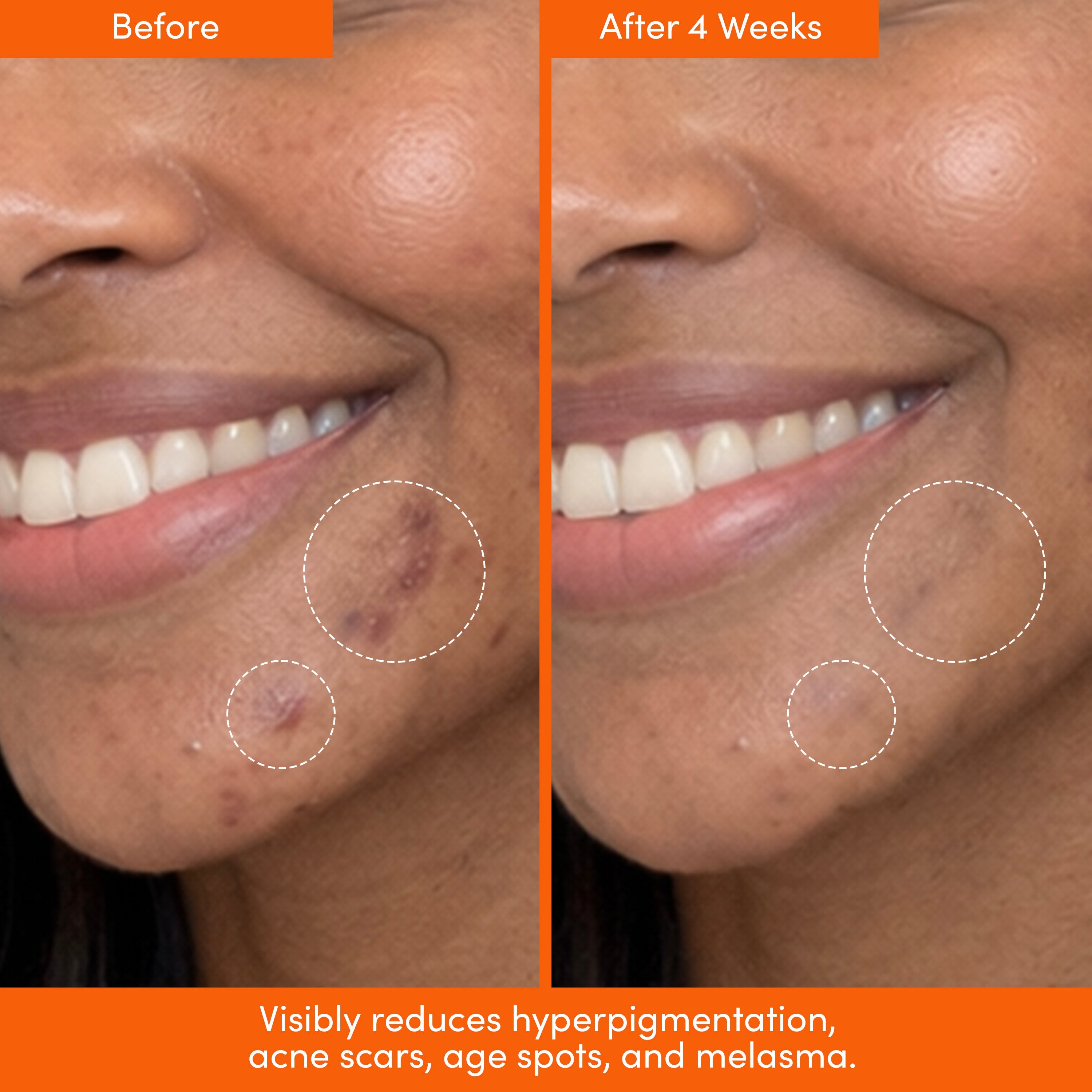 Lion Pose The Placenta Facial dark spot serum and barrier repair cream set for youthful, radiant skin.