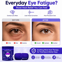 Lure Essentials Eye Serenity Steam Eye Mask, self-heating warm eye compress for dry eyes, puffiness, sleep, and travel comfort.