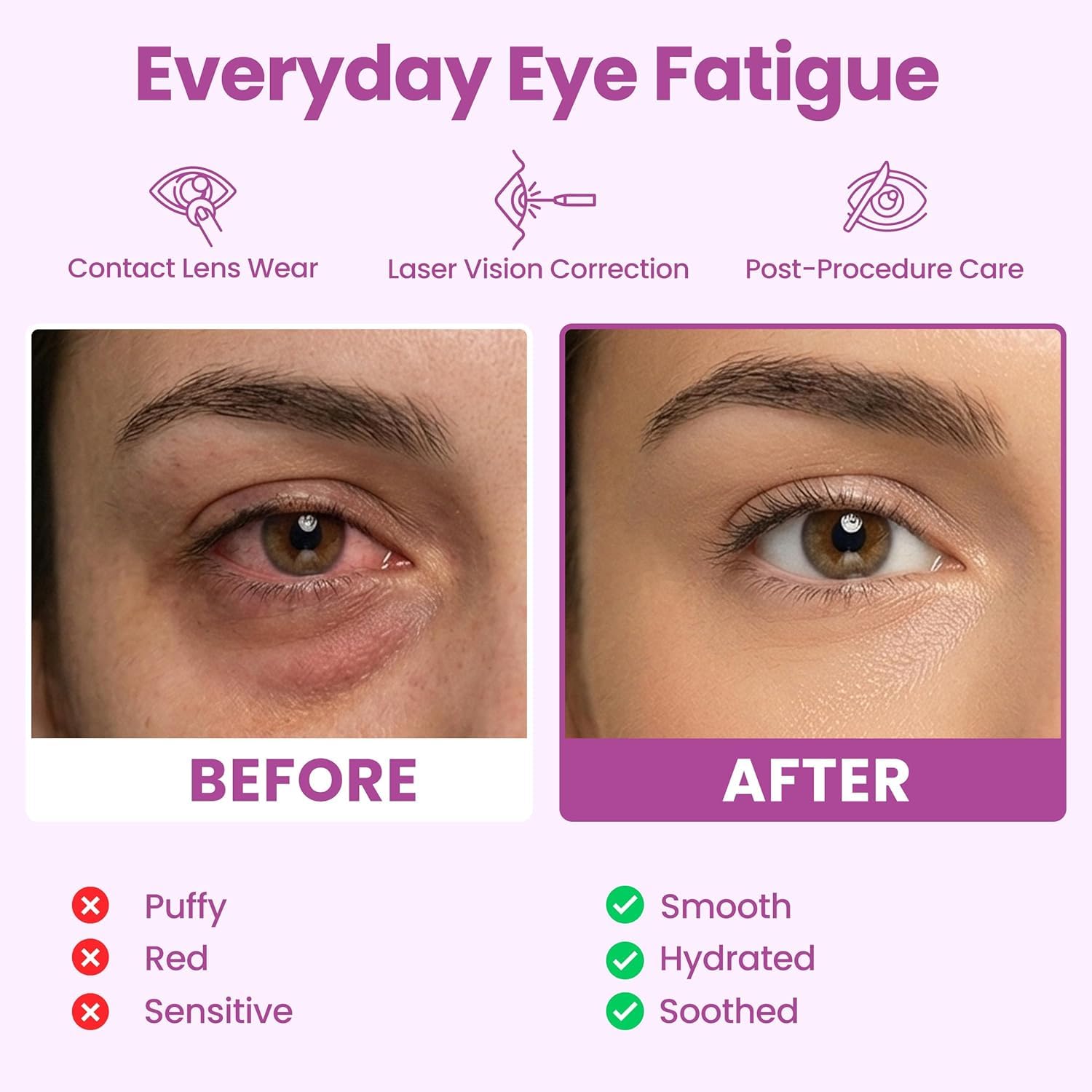 Lure Essentials Eye Serenity Steam Eye Mask variety pack for relaxing eye care and wellness, shown in the image.